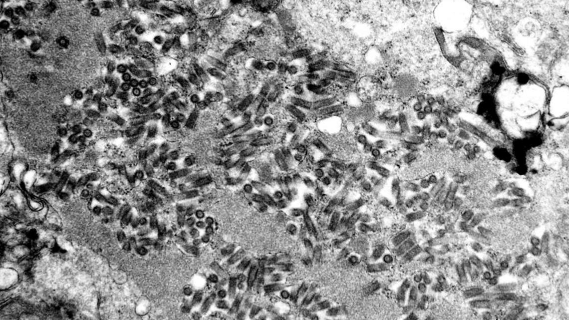 Rabies outbreak confirmed in Hays County