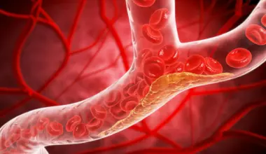 How type 2 diabetes quietly damages blood vessels