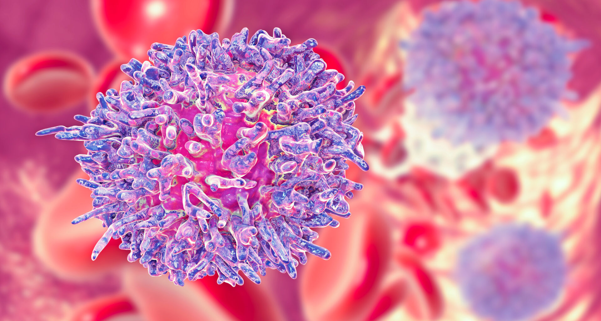 Pirtobrutinib vs Ibrutinib in Chronic Lymphocytic Leukemia/Small Lymphocytic Lymphoma