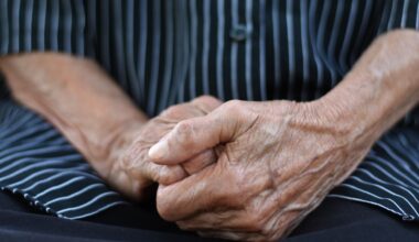 Close-up of the hands of an elderly person that are crossed together over their lap. They are wearing a shirt with black and light blue stripes.