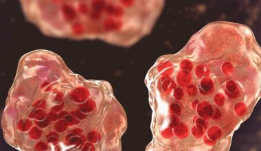 What Doctors Want You to Do After a Measles Exposure