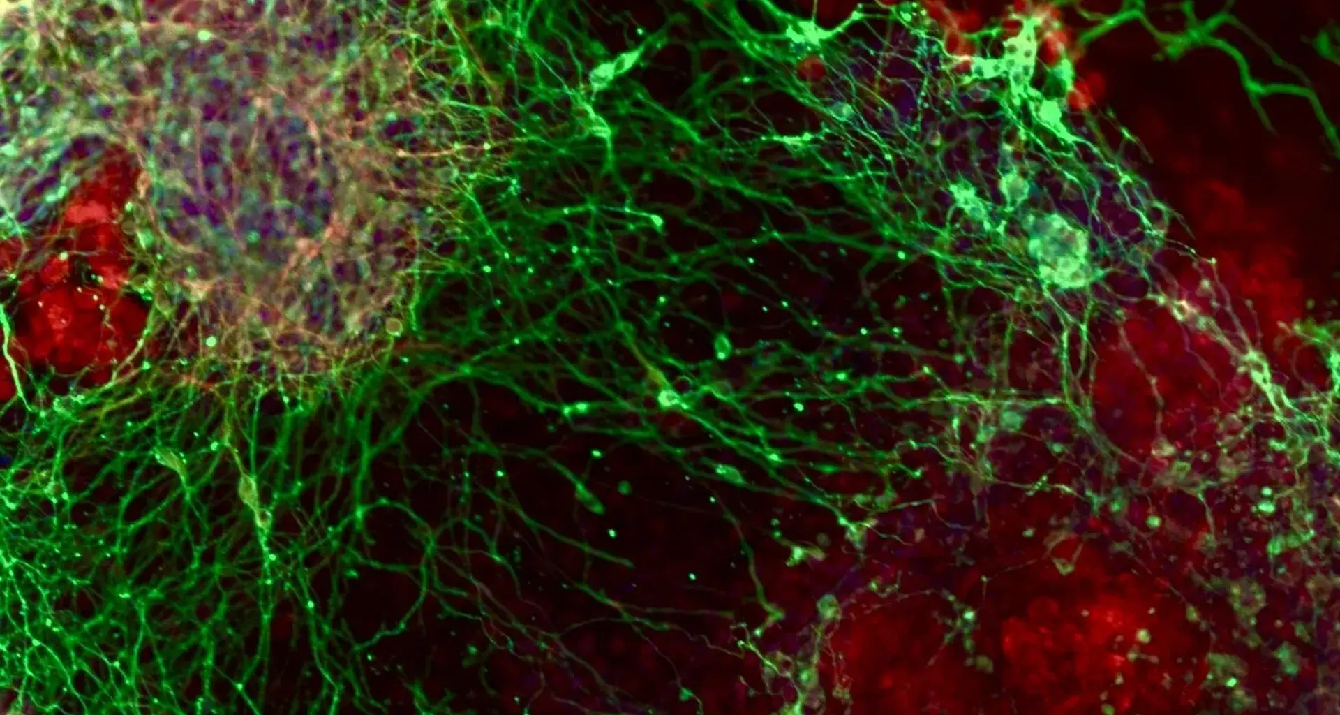 A massive gene hunt reveals how brain cells are made