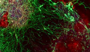 A massive gene hunt reveals how brain cells are made