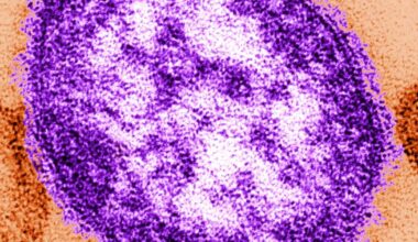 Oregon health officials confirm first measles cases of 2026