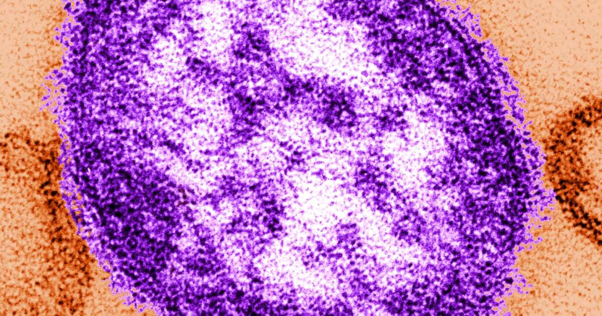 Oregon health officials confirm first measles cases of 2026