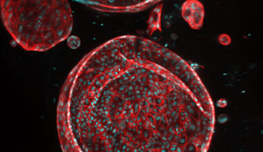 UTSW receives ARPA-H award to create functioning artificial liver: Newsroom