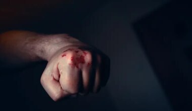 Lawsuit filed against Arab who assaulted haredi youth in Old City