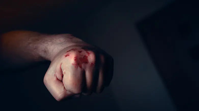 Lawsuit filed against Arab who assaulted haredi youth in Old City