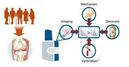 New Molecular Maps of Bone Could Transform Early Osteoarthritis Detection