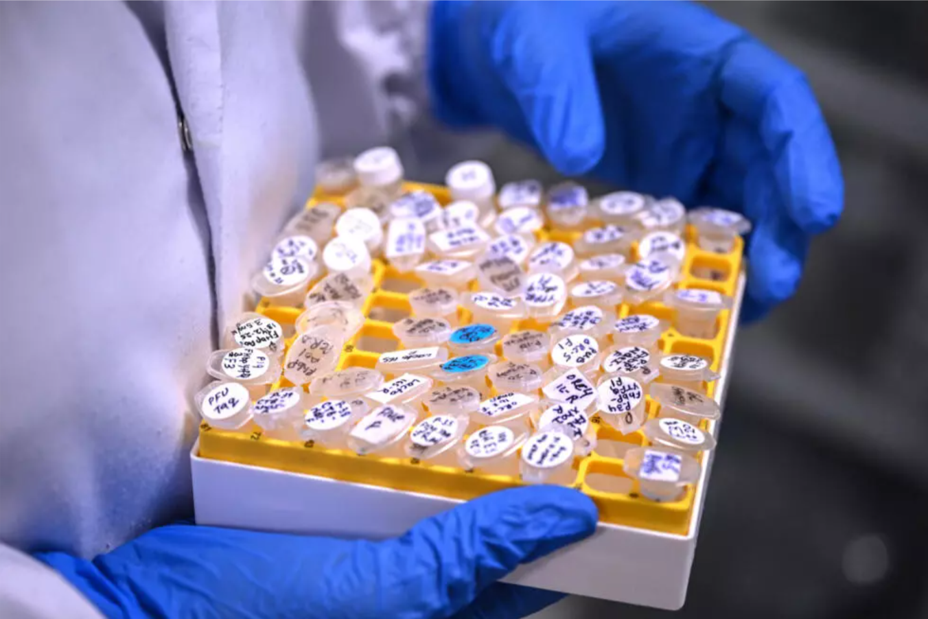 India Moves Closer to Dengue Vaccine as Final Trials Underway