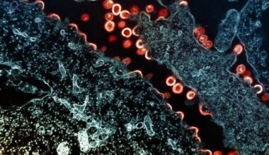 Transmission electron micrograph of HIV-1 virus particles (red/yellow) budding and replicating from a segment of a chronically infected H9 cell (blue/teal).