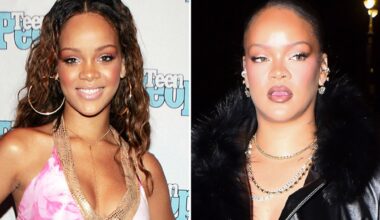 Rihanna Good Genes or Good Docs?!