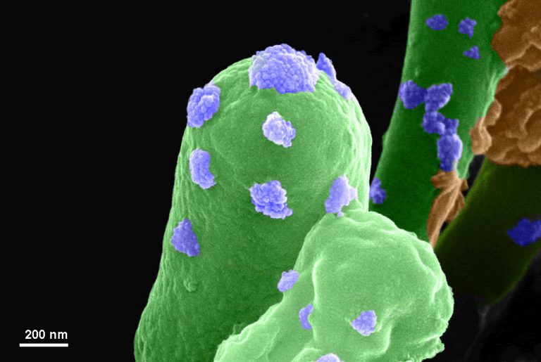 A scanning electron microscope image with green finger-like vertical projections covered with purple bumpy clusters