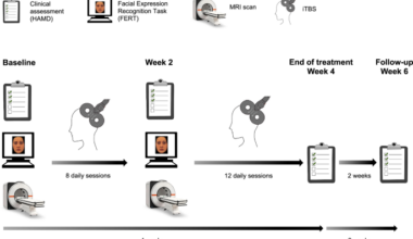 Positive bias in brain and behaviour as a mechanism of transcranial magnetic stimulation depression treatment