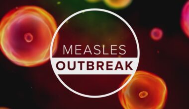 5th measles case of 2026 confirmed in Duval County, Jacksonville's chief health officer says