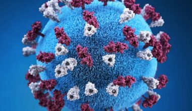 Health officials in Shasta County investigating confirmed case of measles, issues warning to public | News