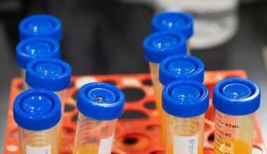 Inside a Supplement Factory Beloved by Influencers and Doctors