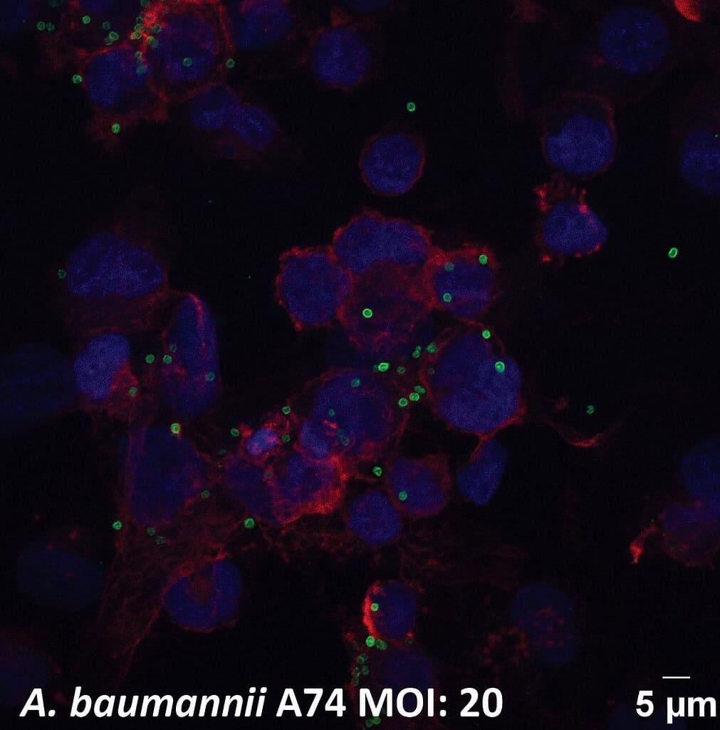 Fluorescent microscopy image of A. baumannii bacteria cells with MOI 20.