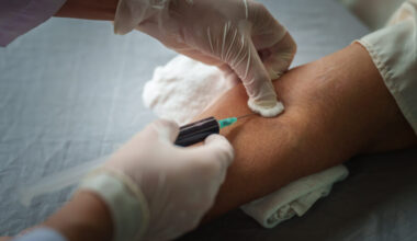 As telehealth firms market multi-cancer tests, doctors are wary