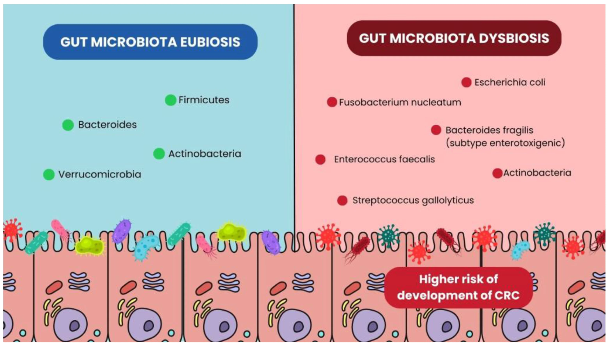 Bacterial differences in Gut Microbiota eubiosis and dysbiosis conditions.1