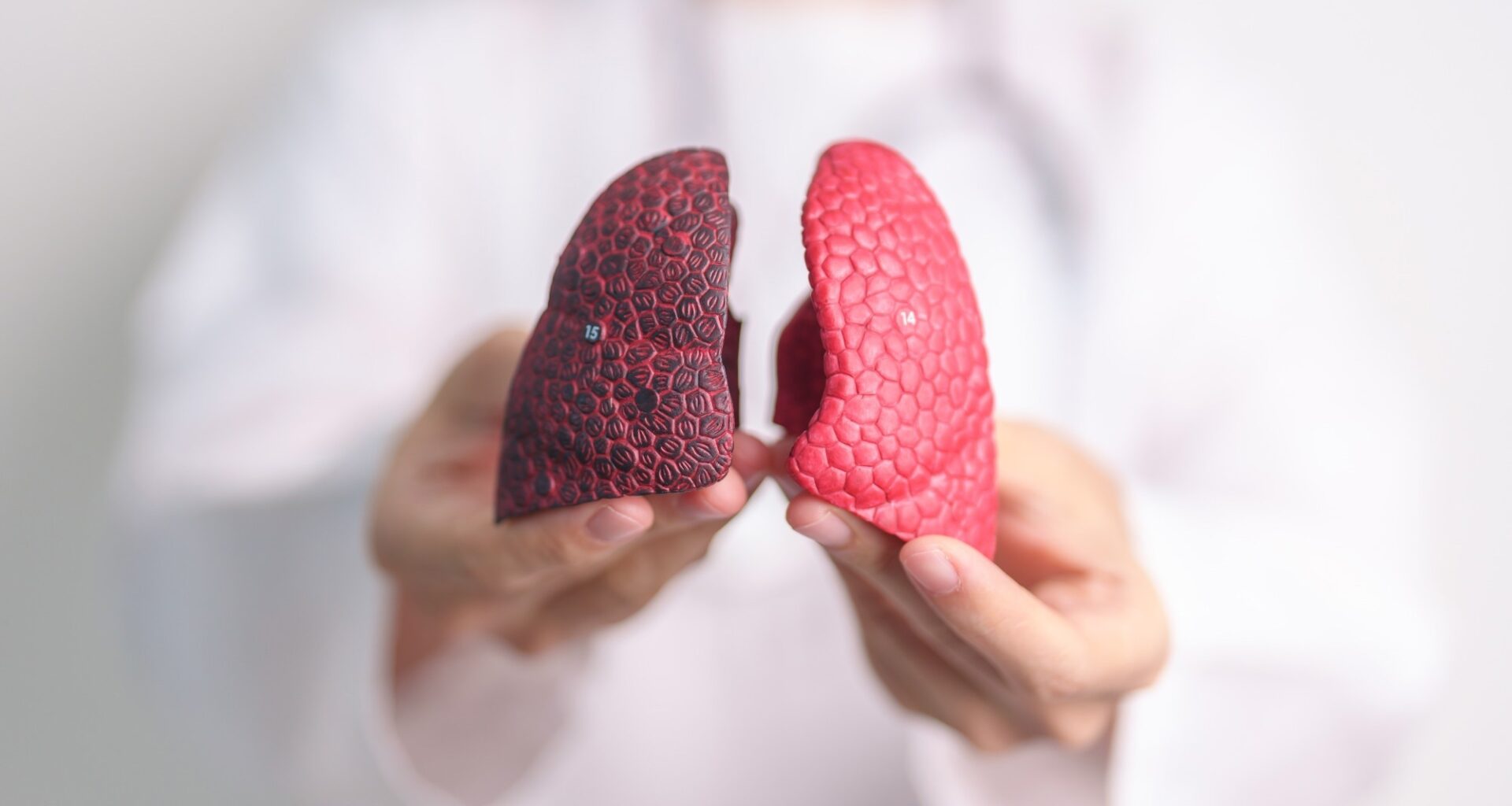 Opinion: Lung cancer in never smokers: from early detection to prevention. Image Credit: Jo Panuwat D / Shutterstock