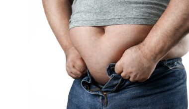 Study: Adult obesity and risk of severe infections: a multicohort study with global burden estimates. Image Credit: rangizzz / Shutterstock