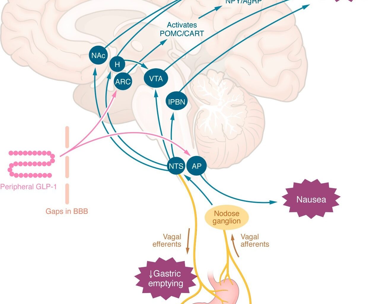 Central mechanisms by which peripheral GLP-1RAs may reduce appetite or induce nausea. Peripheral GLP-1 or GLP-1RAs may interact with appetite-regulating regions of the brain via gaps in the blood-brain barrier, via tanycyte uptake, or indirectly via the nodose ganglia. The effects to slow gastric emptying, induce nausea, and reduce energy intake are independent. AgRP, agouti-related peptide; AP, area postrema; ARC, arcuate nucleus; BBB, blood-brain barrier; CART, cocaine- and amphetamine-regulated transcript; H, hypothalamus; lPBN, lateral parabrachial nucleus; NAc, nucleus accumbens; NPY, neuropeptide Y; NTS, nucleus tractus solitarius; POMC, proopiomelanocortin; VTA, ventral tegmental area.
