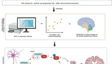 Study: Neuronal PPP2R5C in plasma is a potential biomarker for early diagnosis of Alzheimer’s disease