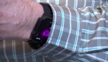 Man says smart watch saved his life – NBC 5 Dallas-Fort Worth