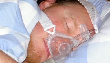 New study uncovers link between pediatric OSA and higher risk of viral infections