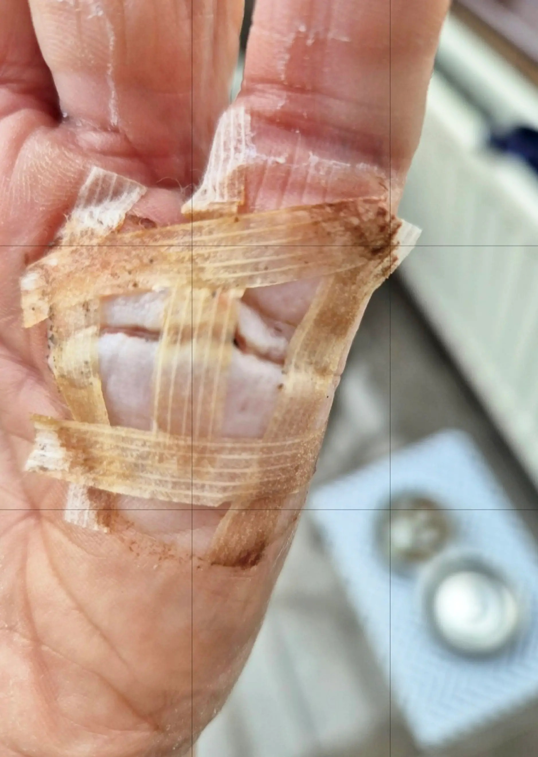 Elizabeth was left needing surgery (SWNS)