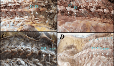 Prevalence of Fusion Between Adjacent Thoracic Spinous Processes in Adult Cadavers