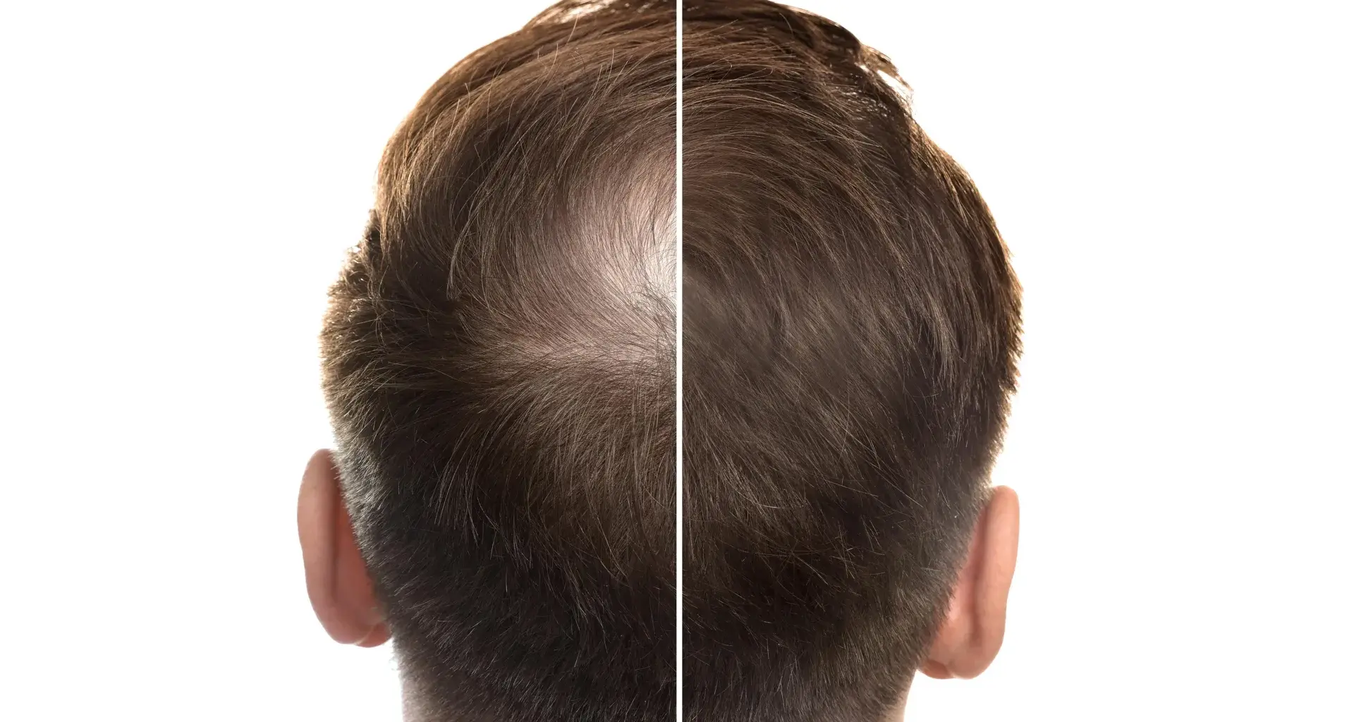 Ancient Chinese medicine may hold the key to hair regrowth