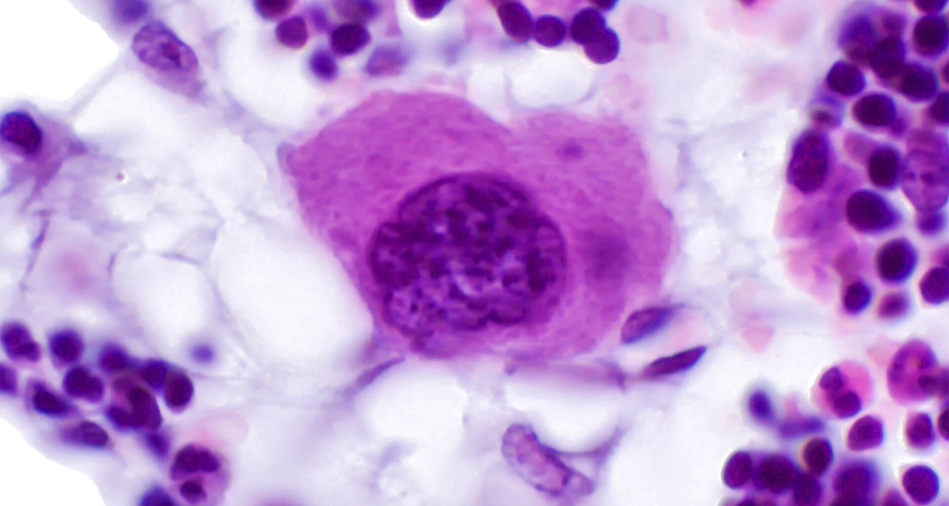 Scientists find the stem cell sensor 'switch' that keeps bones strong