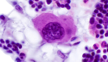 Scientists find the stem cell sensor 'switch' that keeps bones strong