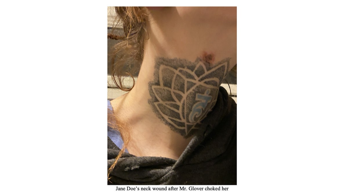 Jane Doe Crispin Glover alleged wound