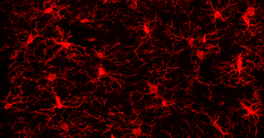 Microglia implicated in infantile amnesia