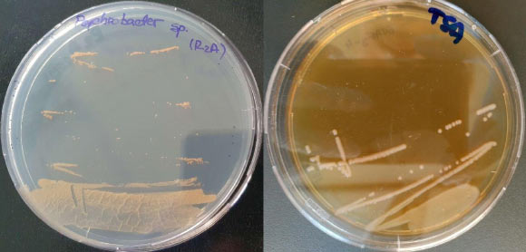 Isolated colonies of Psychrobacter SC65A.3 on R2A medium at 4 degrees Celsius (A) and on TSA medium at 15 degrees Celsius (B). Image credit: Ioana Paun et al., doi: 10.3389/fmicb.2025.1713017.