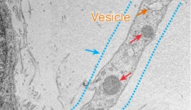 Scientists discover that nerve cells ‘borrow’ power to survive pain