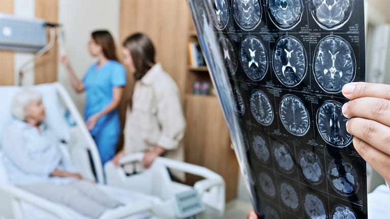 Recovery after a stroke (file image).