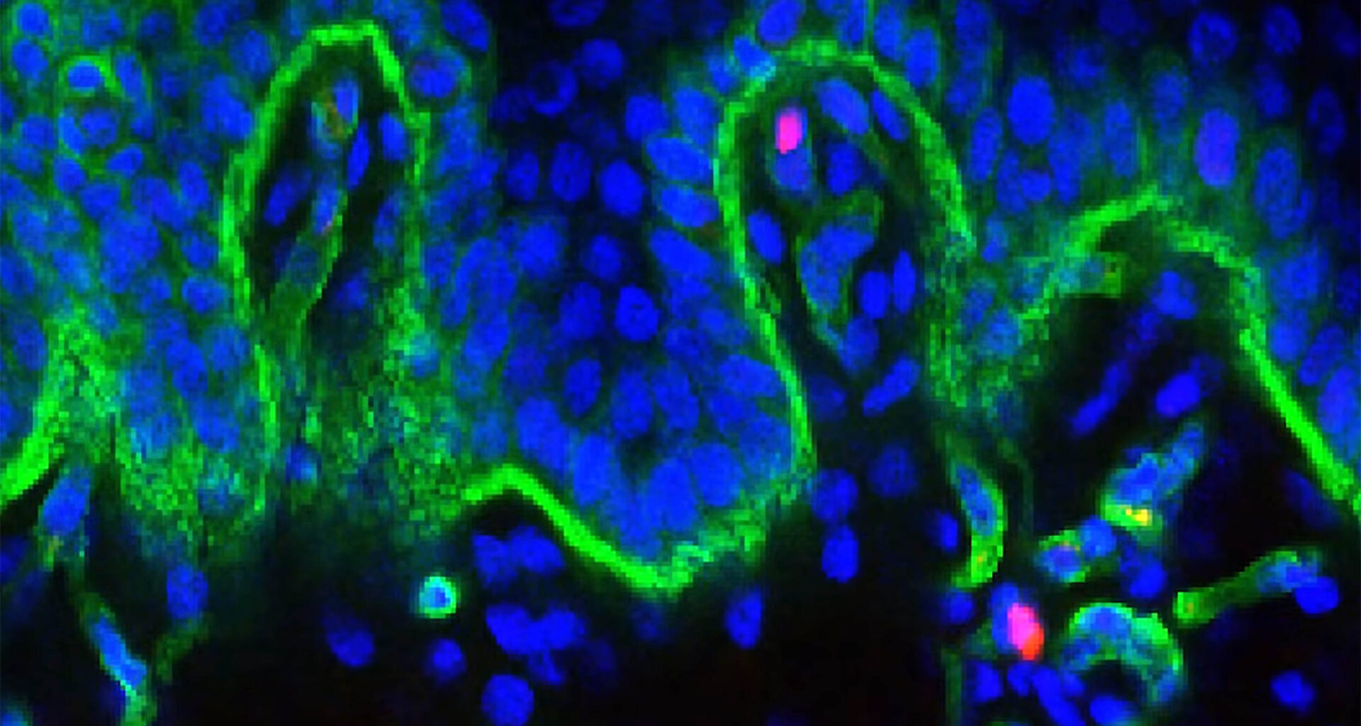 Road map to youthful human skin found in pigs and grizzly bears