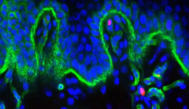 Road map to youthful human skin found in pigs and grizzly bears