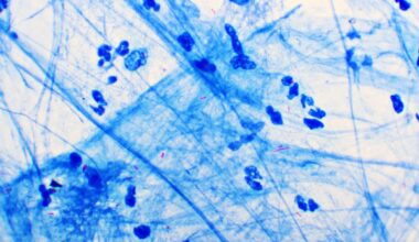 Tuberculosis Mycobacteria Use Stealth to Evade Immune System