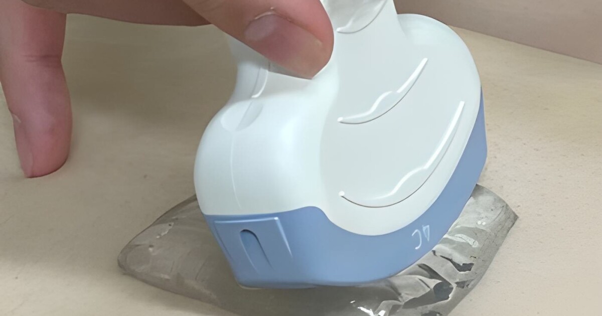 New sonogram pads eliminate cold gel for better patient comfort