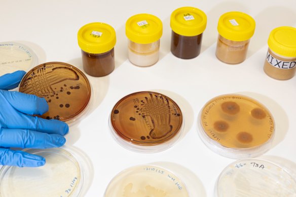 A range of honeys were tested against E.Coli and golden staph, which causes drug-resistant skin infections.