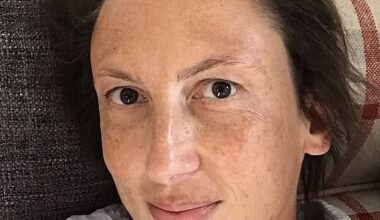 Miranda Hart revealed on Facebook on Wednesday that she has hurt her ankle and can't walk properly as she opened up about her extreme fear of healthcare