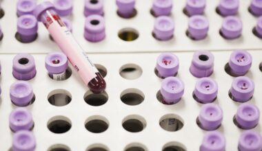 A cholesterol test you've never heard of is now recommended to prevent heart disease