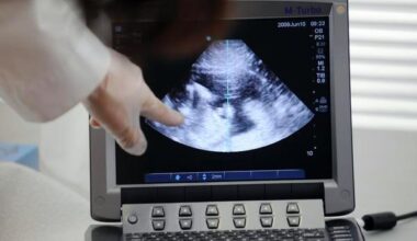 Denver company's AI could flag premature births based on ultrasounds