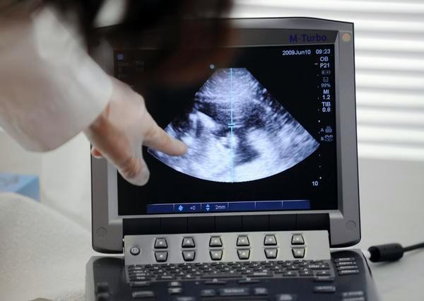 Denver company's AI could flag premature births based on ultrasounds