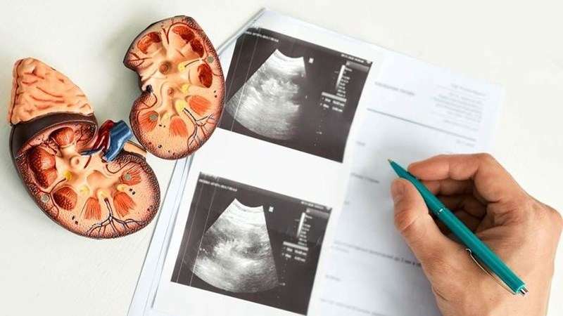 Breakthrough treatments target kidney and heart risk